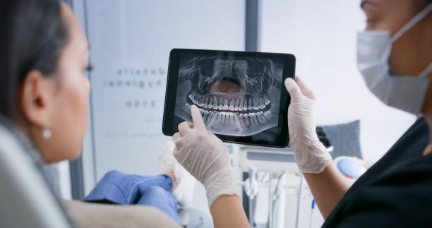 Licensed Tooth Extraction service in Englewood, OH - Smile Center Dentistry